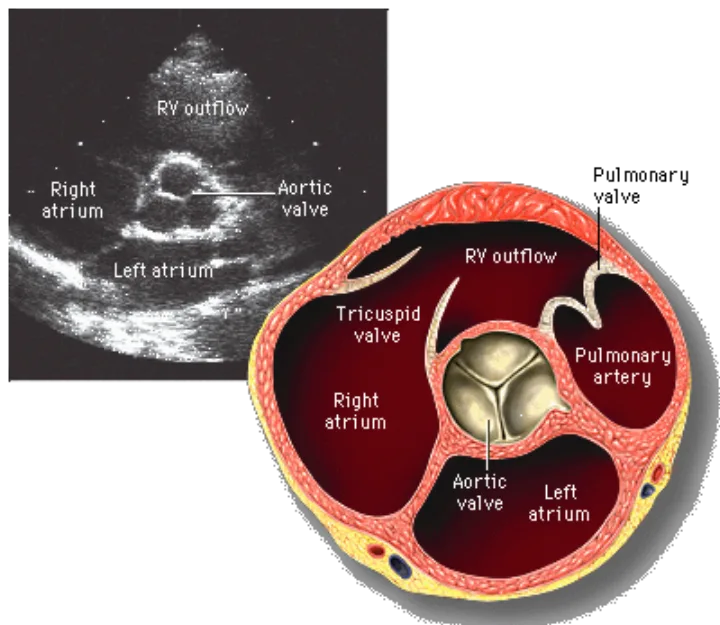 Aortic valve short axis anatomy