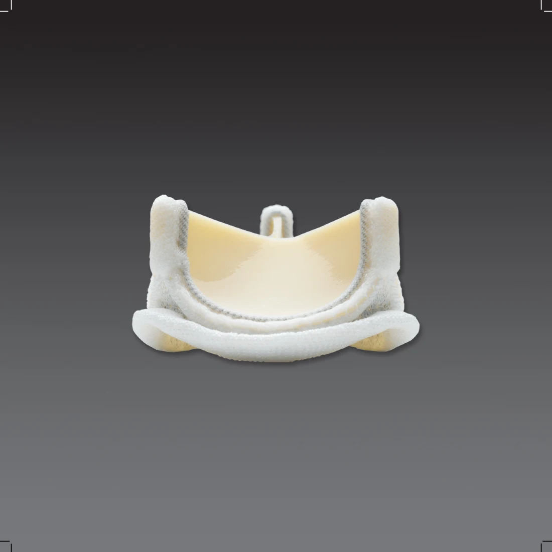 Prosthetic heart valve